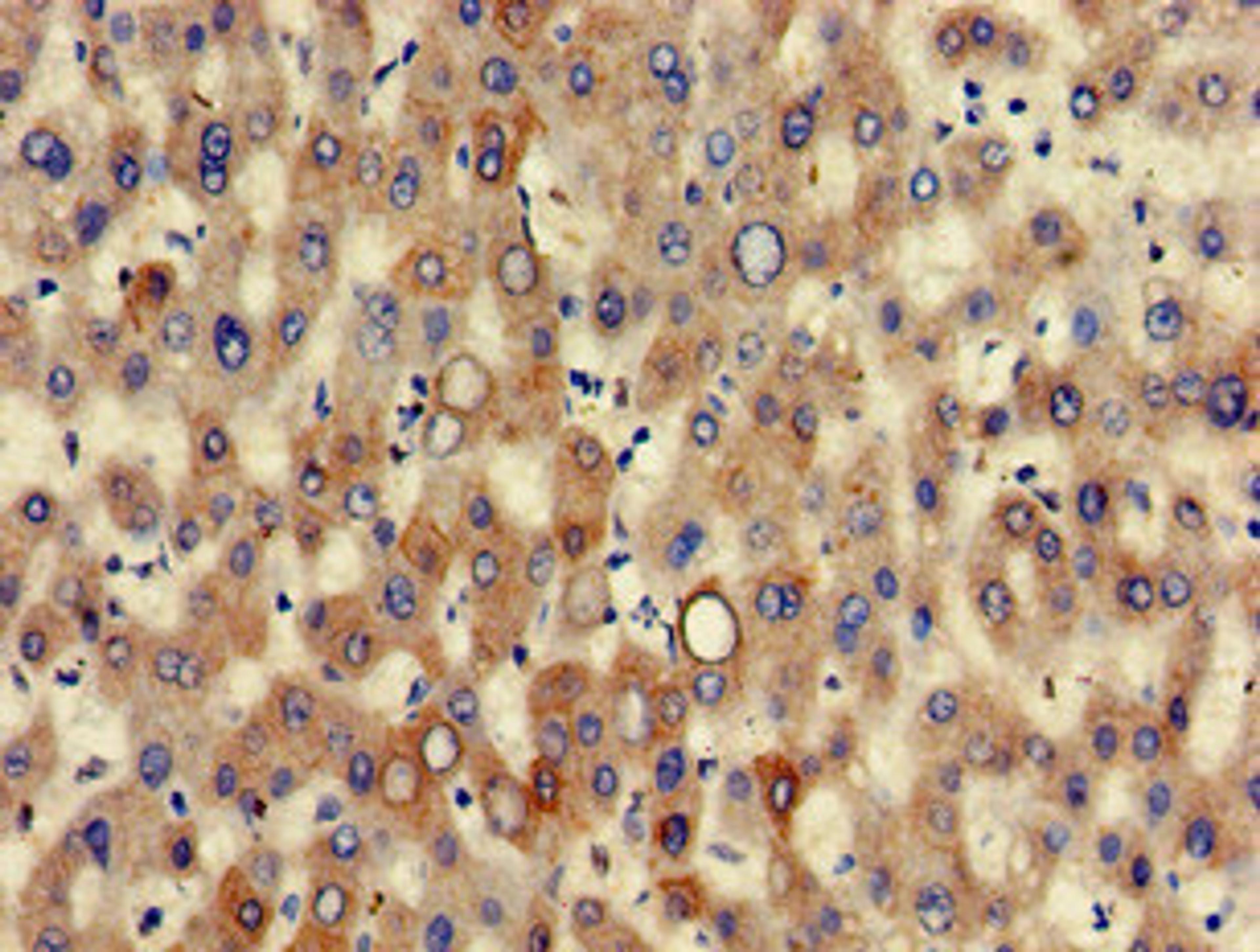 Immunohistochemistry of paraffin-embedded human liver tissue using CSB-PA012564LA01HU at dilution of 1:100