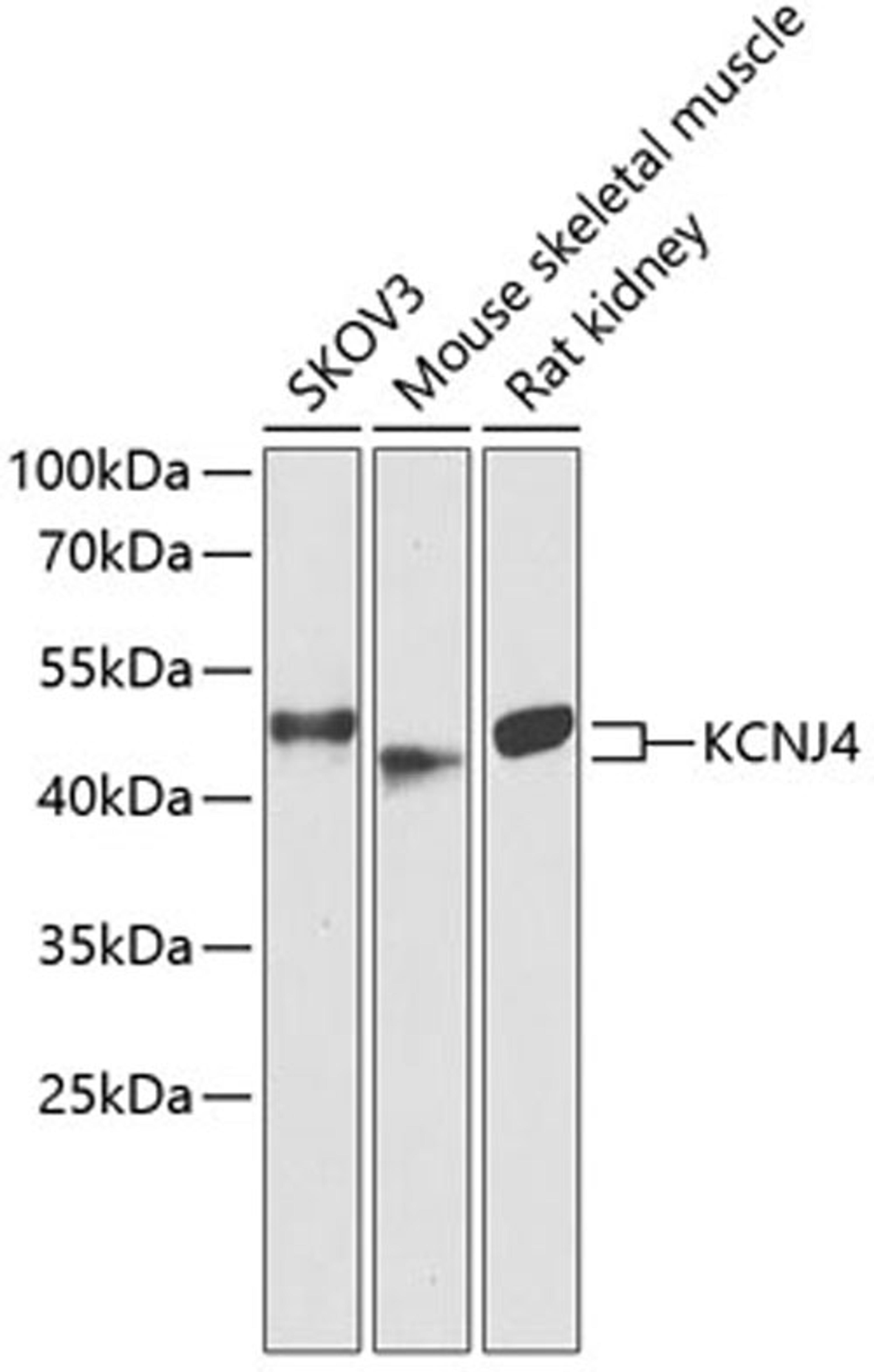 Western blot - KCNJ4 antibody (A14010)