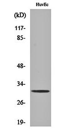 Western blot analysis of HuvEc cell lysates using TIMP-3 antibody