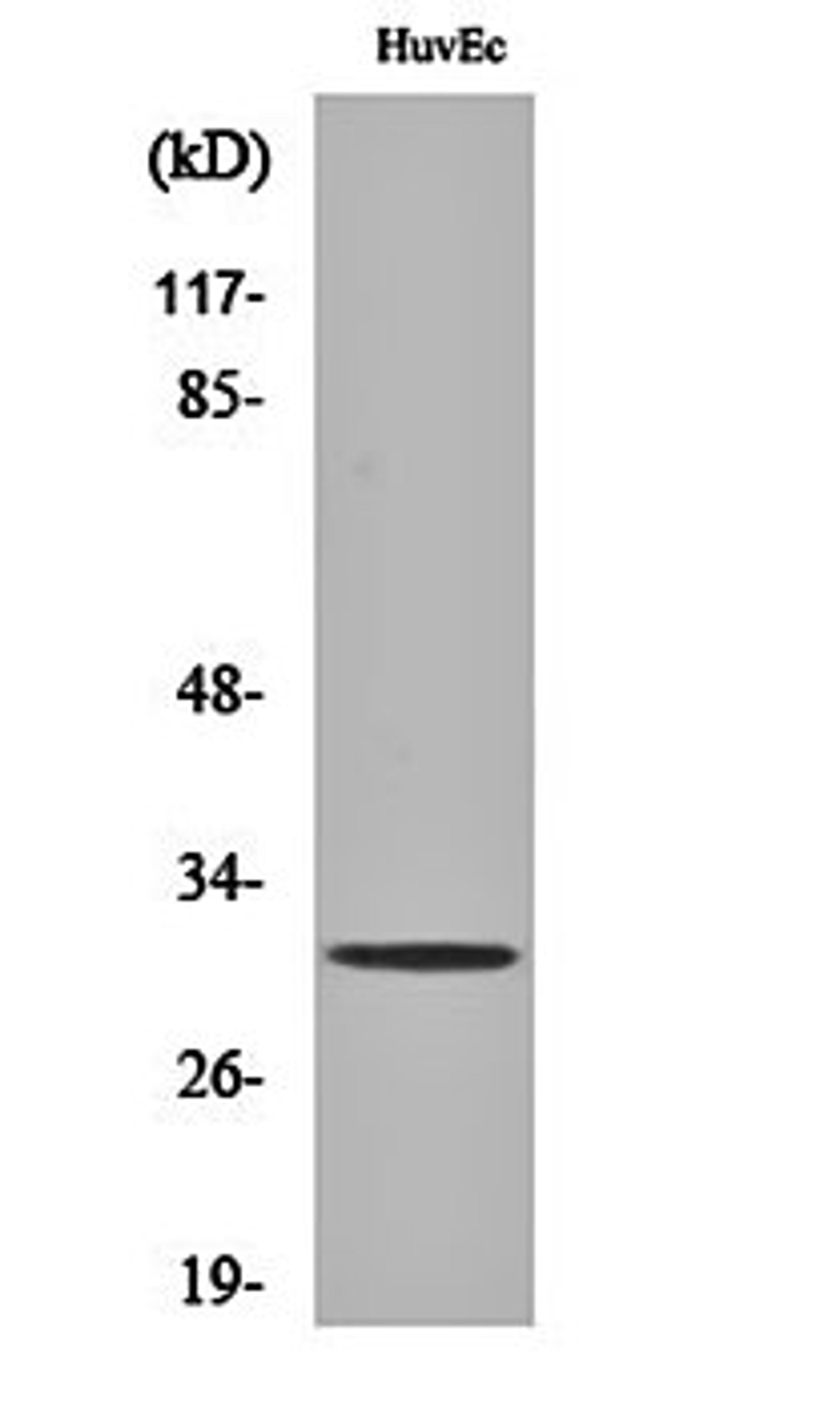 Western blot analysis of HuvEc cell lysates using TIMP-3 antibody