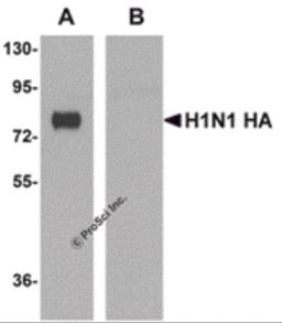 Recombinant seasonal Influenza HA (lane A) or swine-origin Influenza HA (lane B) were probed (1 &#956;g/mL) using monoclonal seasonal Influenza A HA.