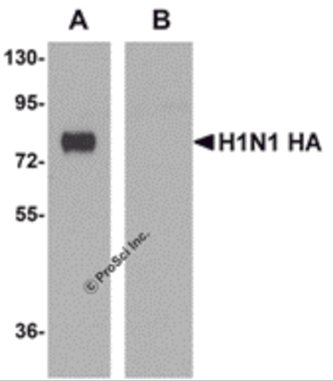 Recombinant seasonal Influenza HA (lane A) or swine-origin Influenza HA (lane B) were probed (1 μg/mL) using monoclonal seasonal Influenza A HA.
