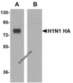 Recombinant seasonal Influenza HA (lane A) or swine-origin Influenza HA (lane B) were probed (1 μg/mL) using monoclonal seasonal Influenza A HA.