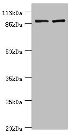 Western blot. All lanes: GCC1 antibody at 2µg/ml. Lane 1: Hela whole cell lysate. Lane 2: 293T whole cell lysate. Secondary. Goat polyclonal to rabbit IgG at 1/10000 dilution. Predicted band size: 88 kDa. Observed band size: 88 kDa