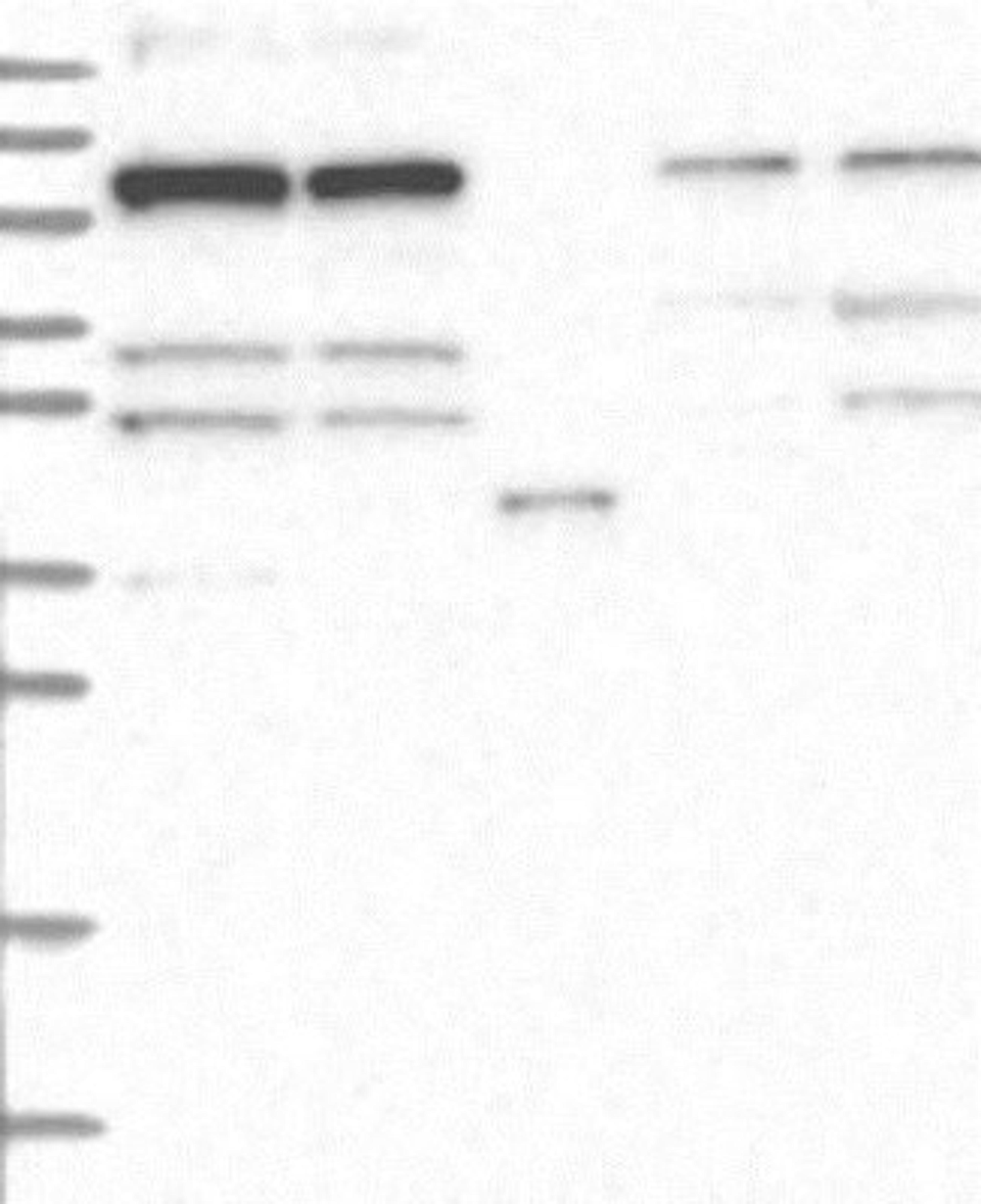 Western Blot: TEX12 Antibody [NBP2-32656] - Lane 1: Marker [kDa] 250, 130, 95, 72, 55, 36, 28, 17, 10 | Lane 2: Negative control (vector only transfected HEK293T lysate) | Lane 3: Over-expression Lysate (Co-expressed with a C-terminal myc-DDK tag (~3.1 kDa) in mammalian HEK293T cells, <a href="http