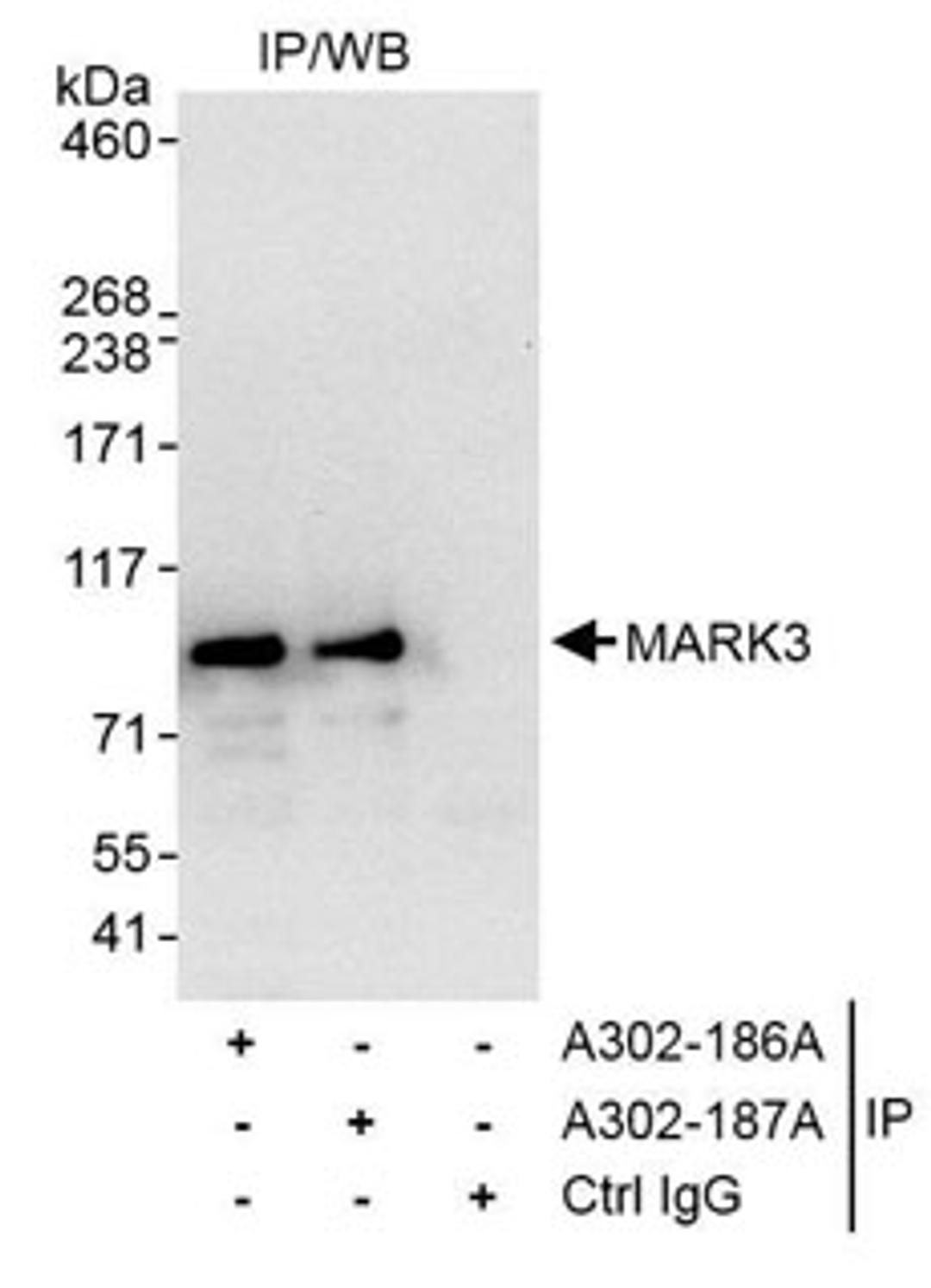 Detection of human MARK3 by western blot of immunoprecipitates.