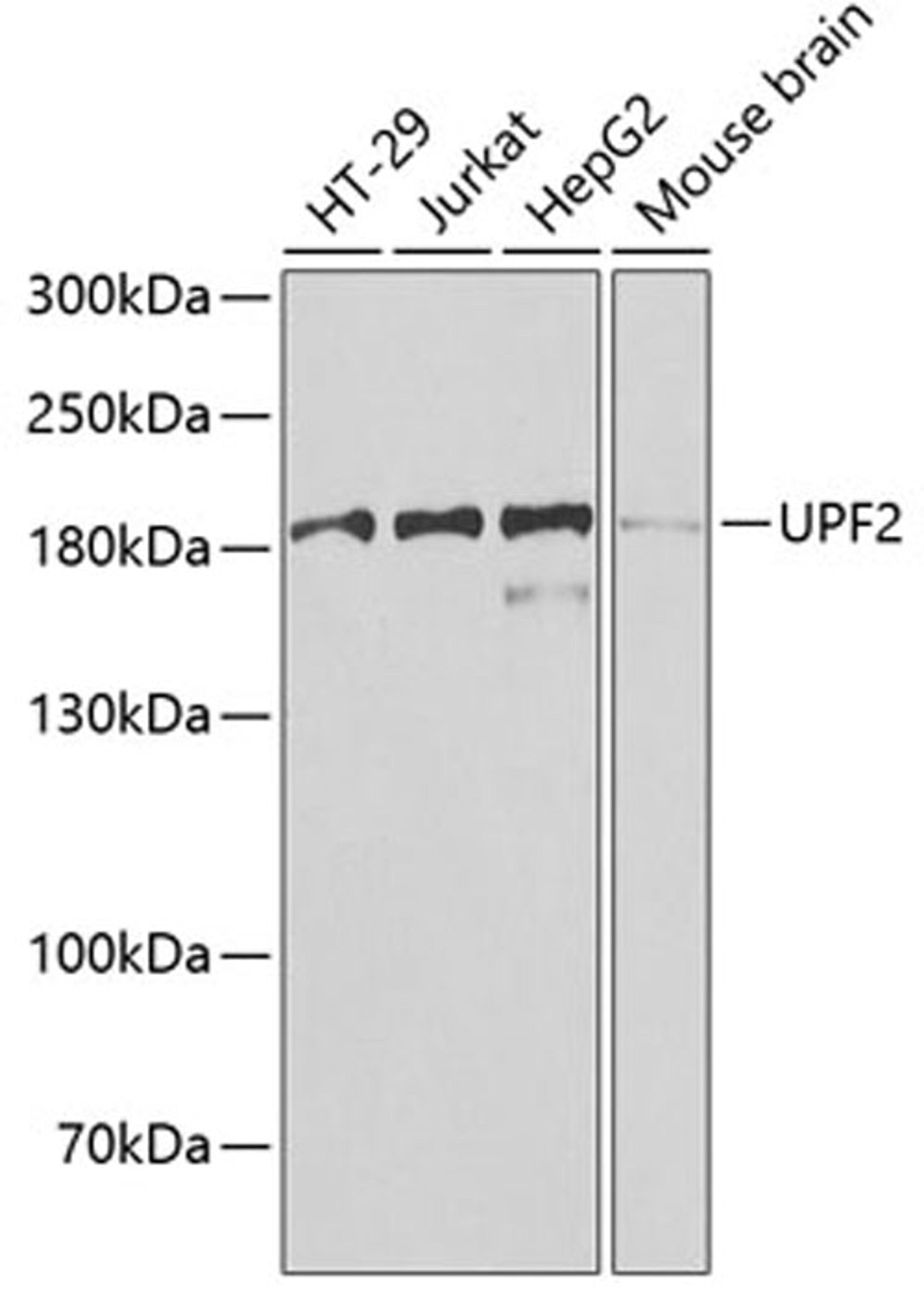 Western blot - UPF2 antibody (A7091)