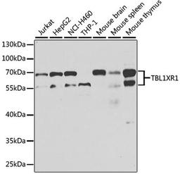 Western blot - TBL1XR1 antibody (A13438)