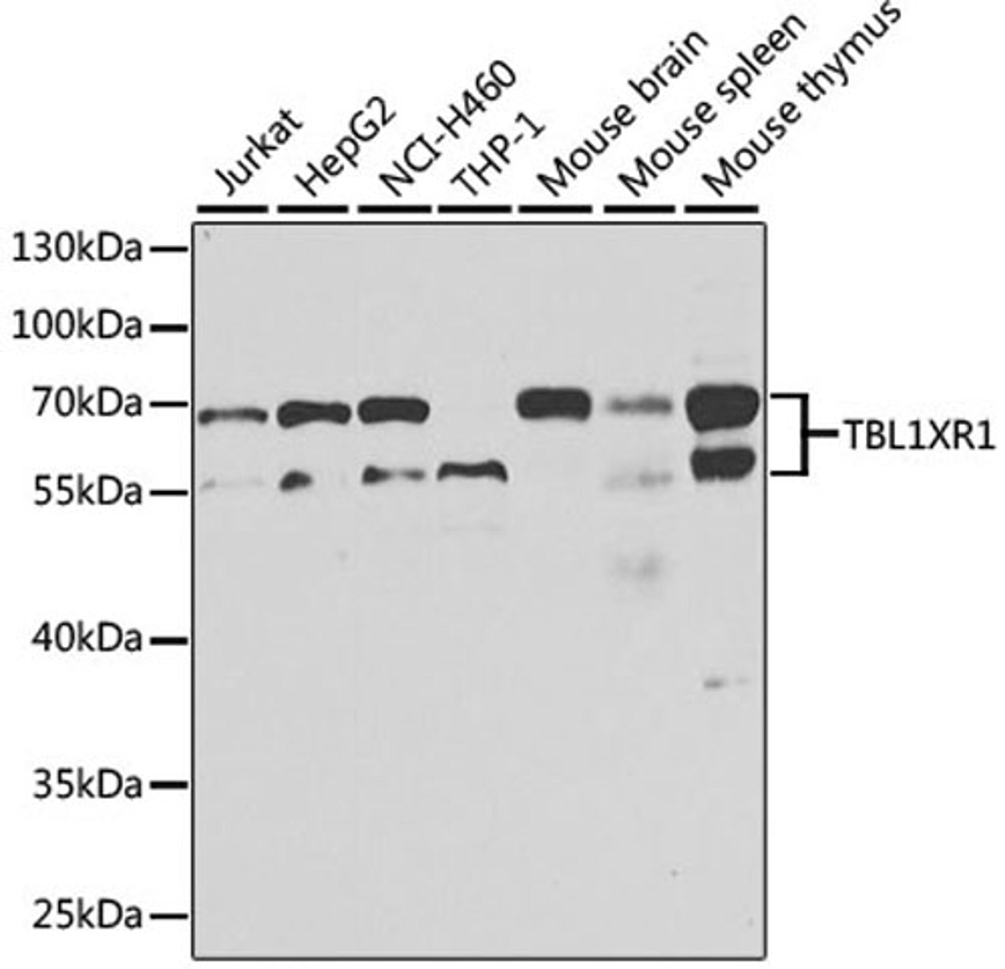 Western blot - TBL1XR1 antibody (A13438)