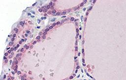 Antibody used in IHC on Human Thyroid at 5.0 ug/ml.