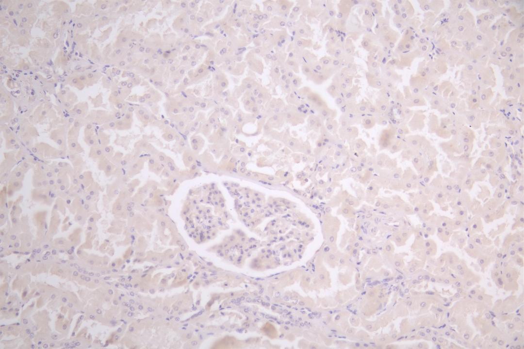 Immunohistochemistry of paraffin-embedded human placenta tissue using CSB-PA822255LA01HU at dilution of 1:100