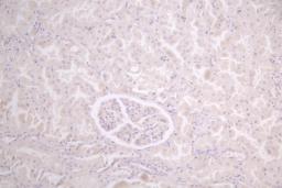 Immunohistochemistry of paraffin-embedded human placenta tissue using CSB-PA822255LA01HU at dilution of 1:100