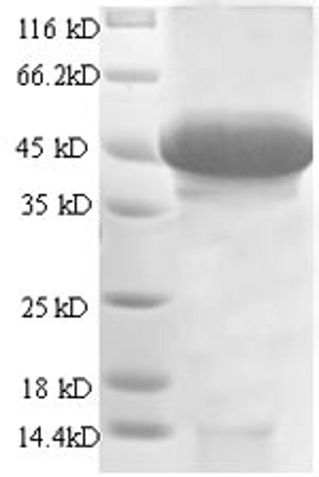(Tris-Glycine gel) Discontinuous SDS-PAGE (reduced) with 5% enrichment gel and 15% separation gel.
