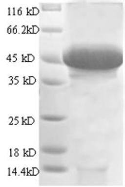 (Tris-Glycine gel) Discontinuous SDS-PAGE (reduced) with 5% enrichment gel and 15% separation gel.