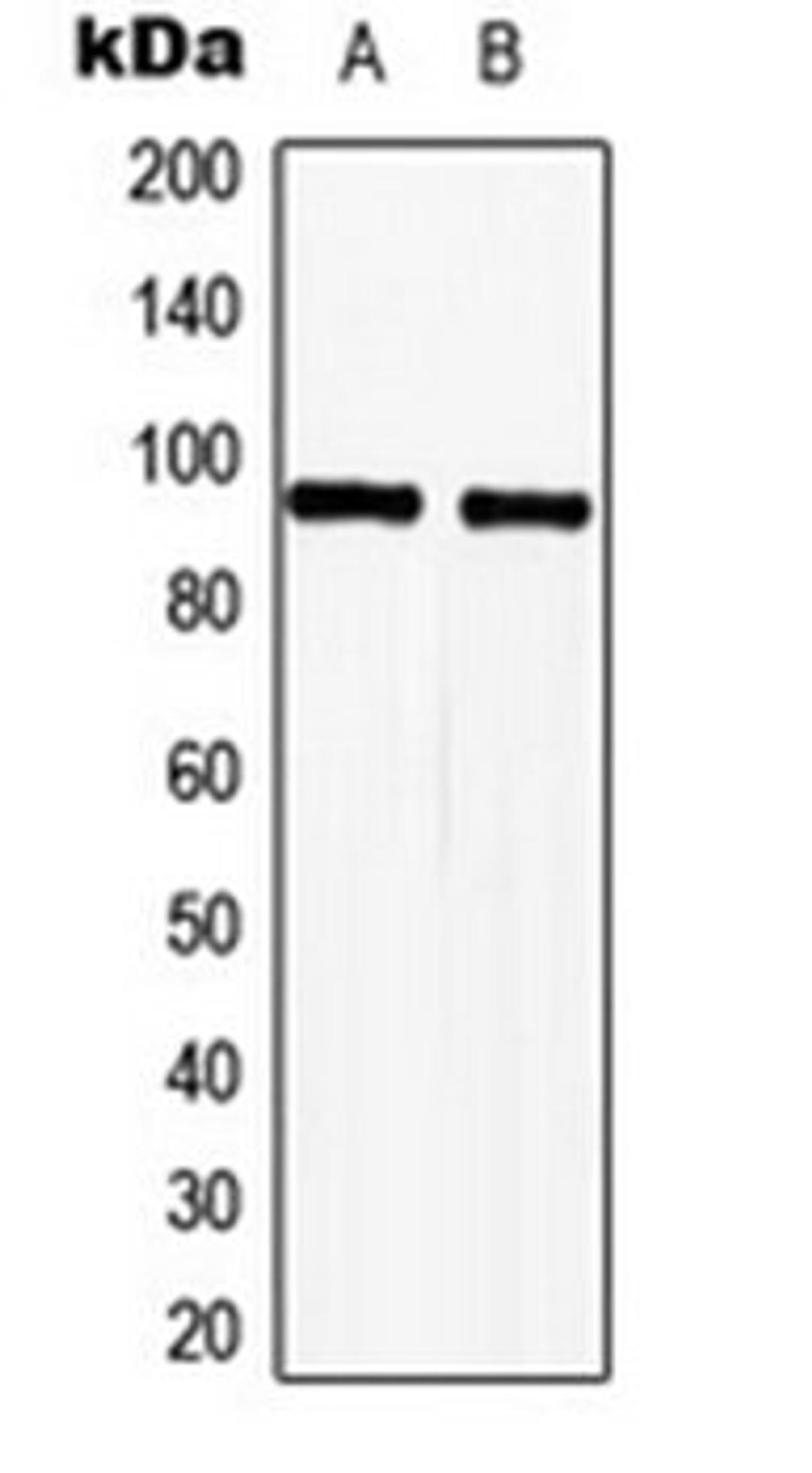 Western blot analysis of HeLa (Lane 1), Jurkat (Lane 2) whole cell lysates using TLE2 antibody