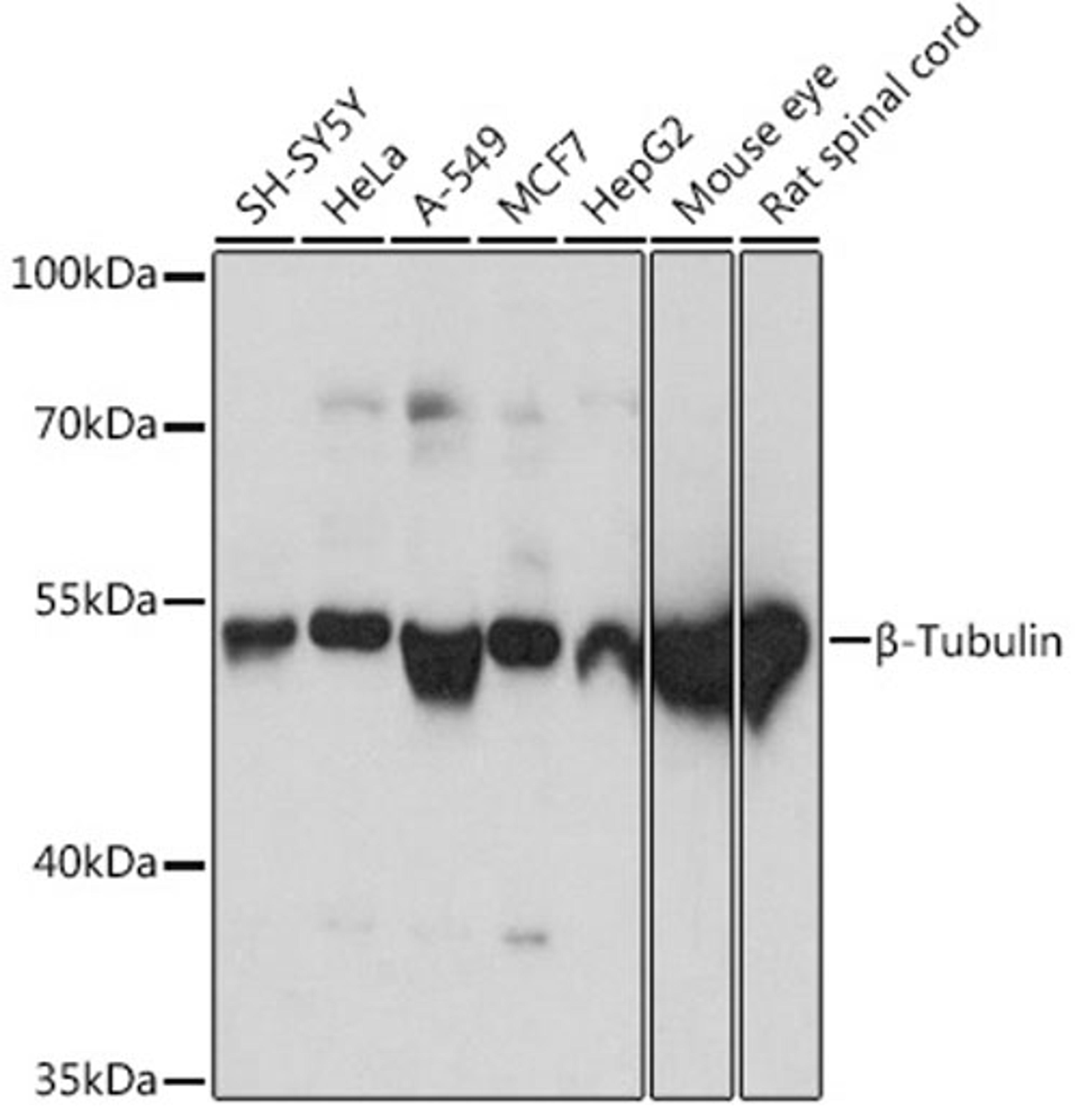 Western blot - TUBB antibody (AC015)