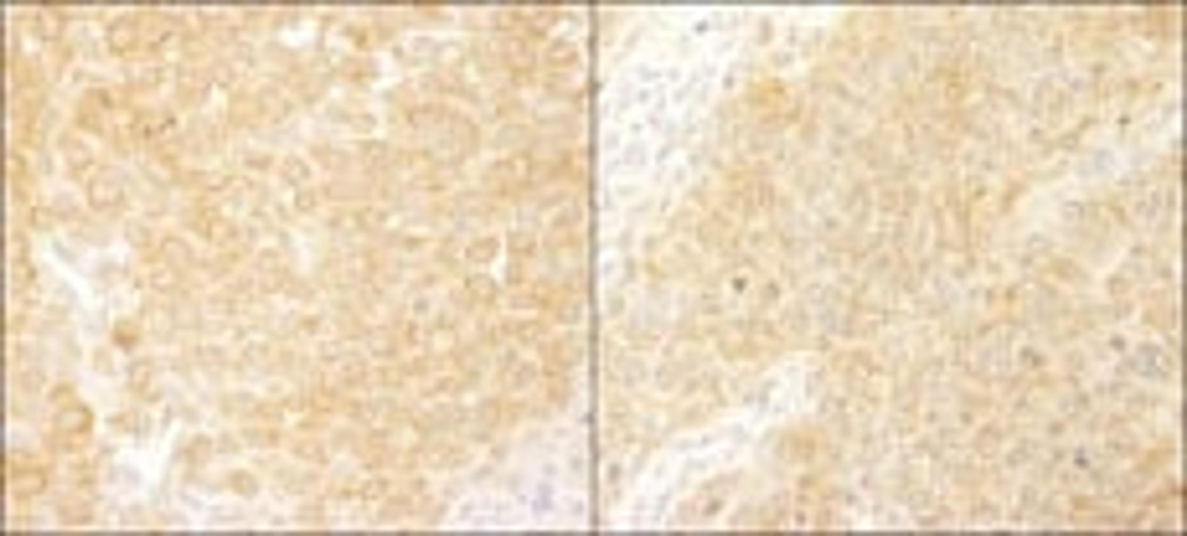 Detection of human and mouse BCAR1/p130CAS by immunohistochemistry.