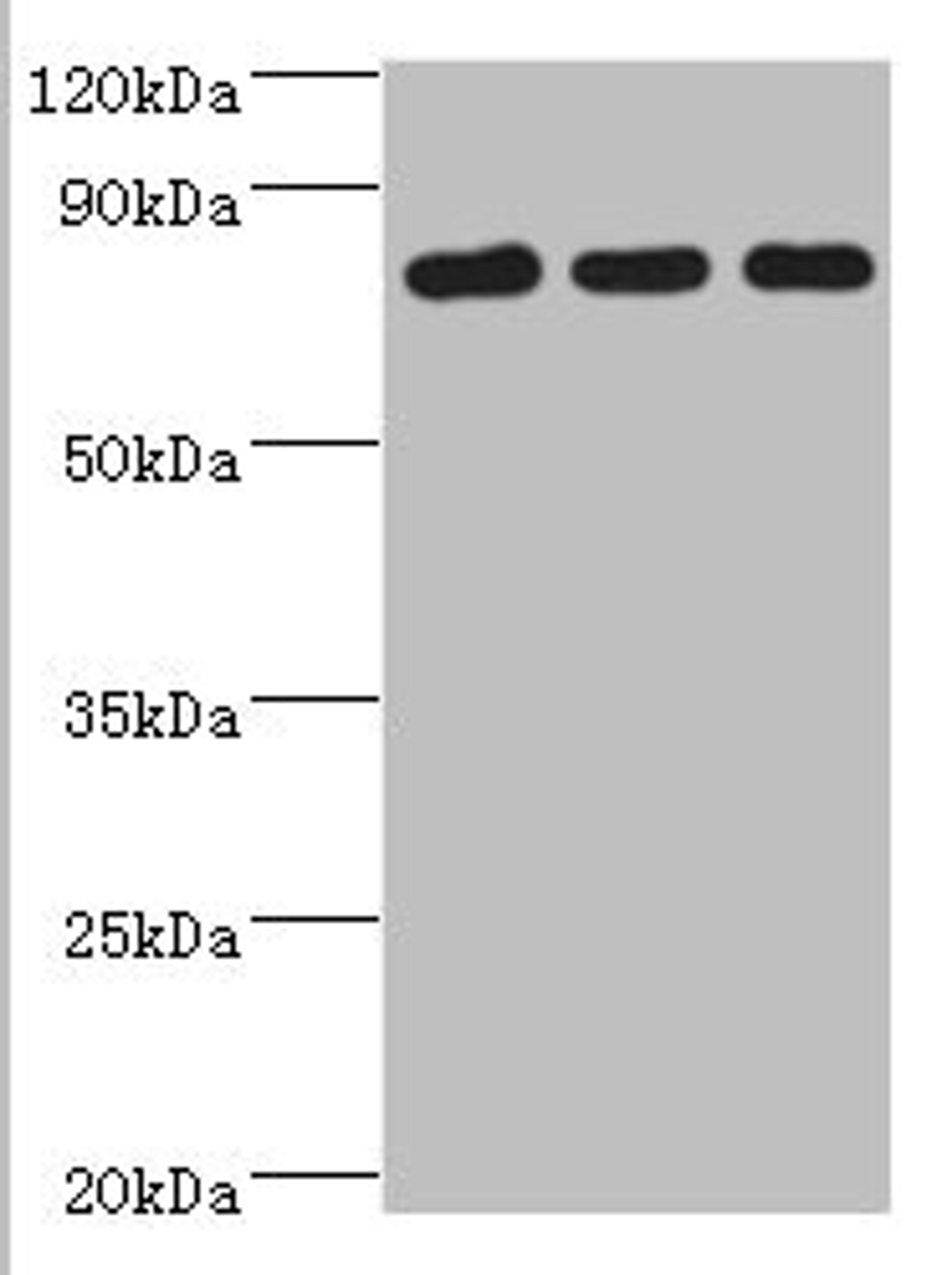 Western blot. All lanes: CXXC-type zinc finger protein 1 antibody at 2ug/ml. Lane 1: THP-1 whole cell lysate. Lane 2: Mouse liver tissue. Lane 2: Mouse spleen tissue. Secondary. Goat polyclonal to rabbit IgG at 1/10000 dilution. Predicted band size: 76, 77 kDa. Observed band size: 76 kDa. 