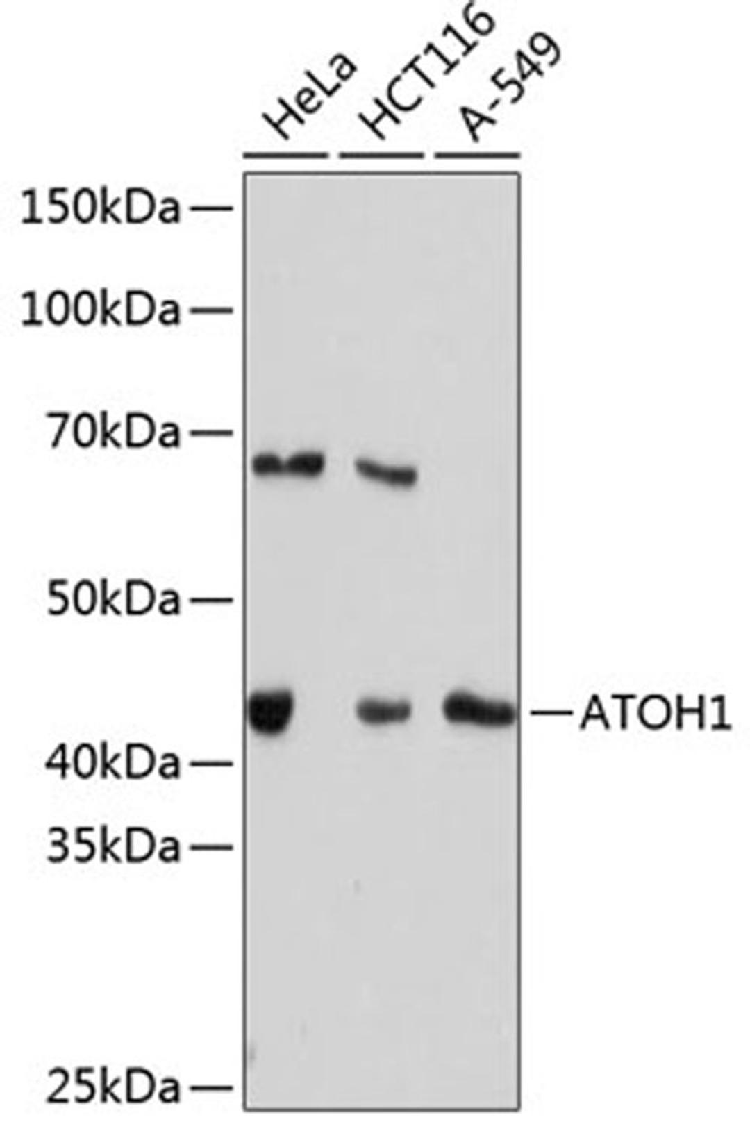 Western blot - ATOH1 Rabbit mAb (A11477)