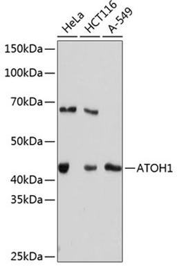 Western blot - ATOH1 Rabbit mAb (A11477)