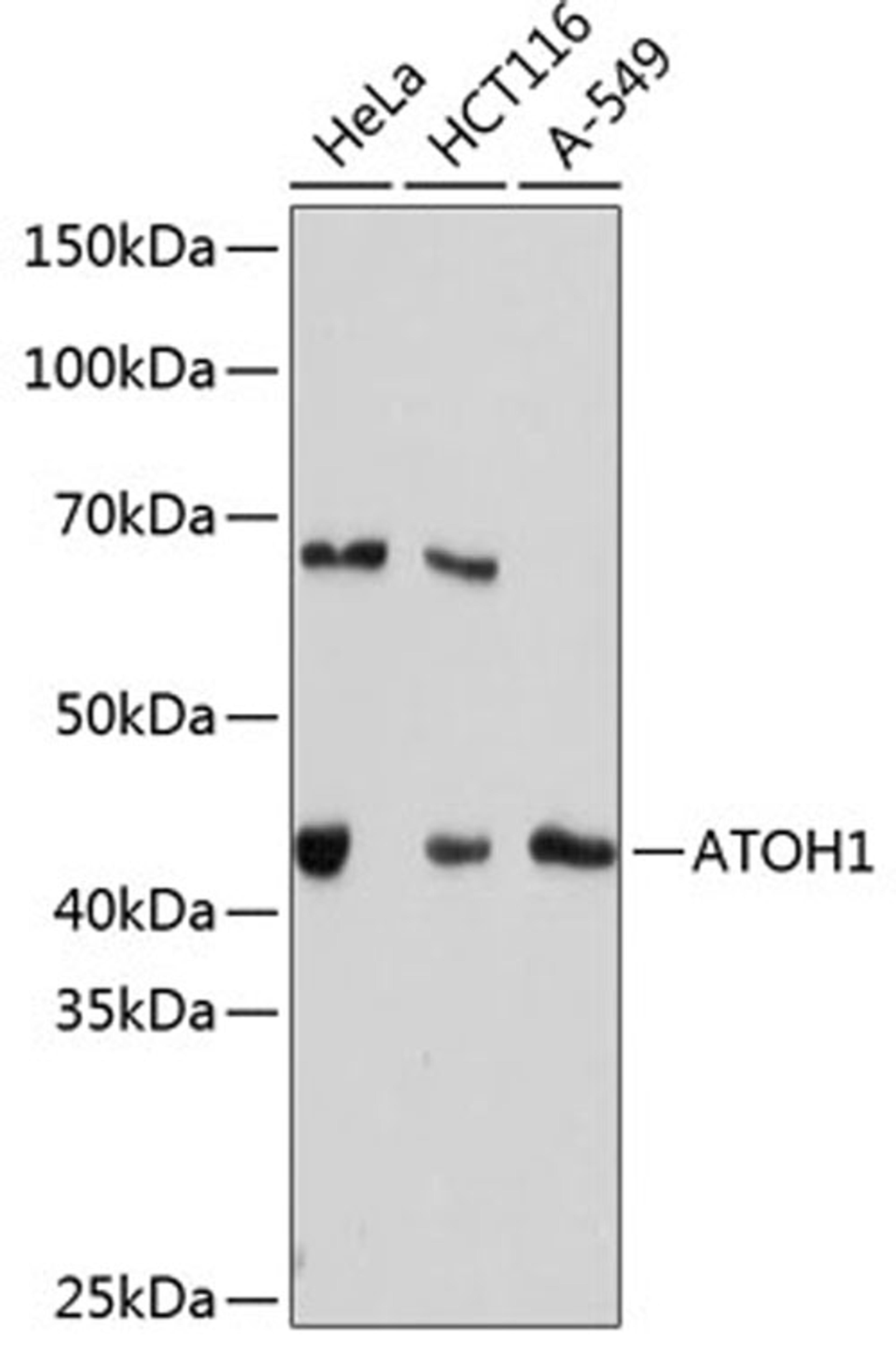 Western blot - ATOH1 Rabbit mAb (A11477)