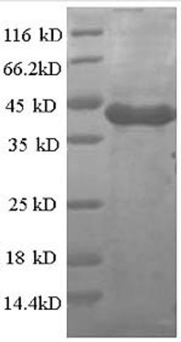 (Tris-Glycine gel) Discontinuous SDS-PAGE (reduced) with 5% enrichment gel and 15% separation gel.