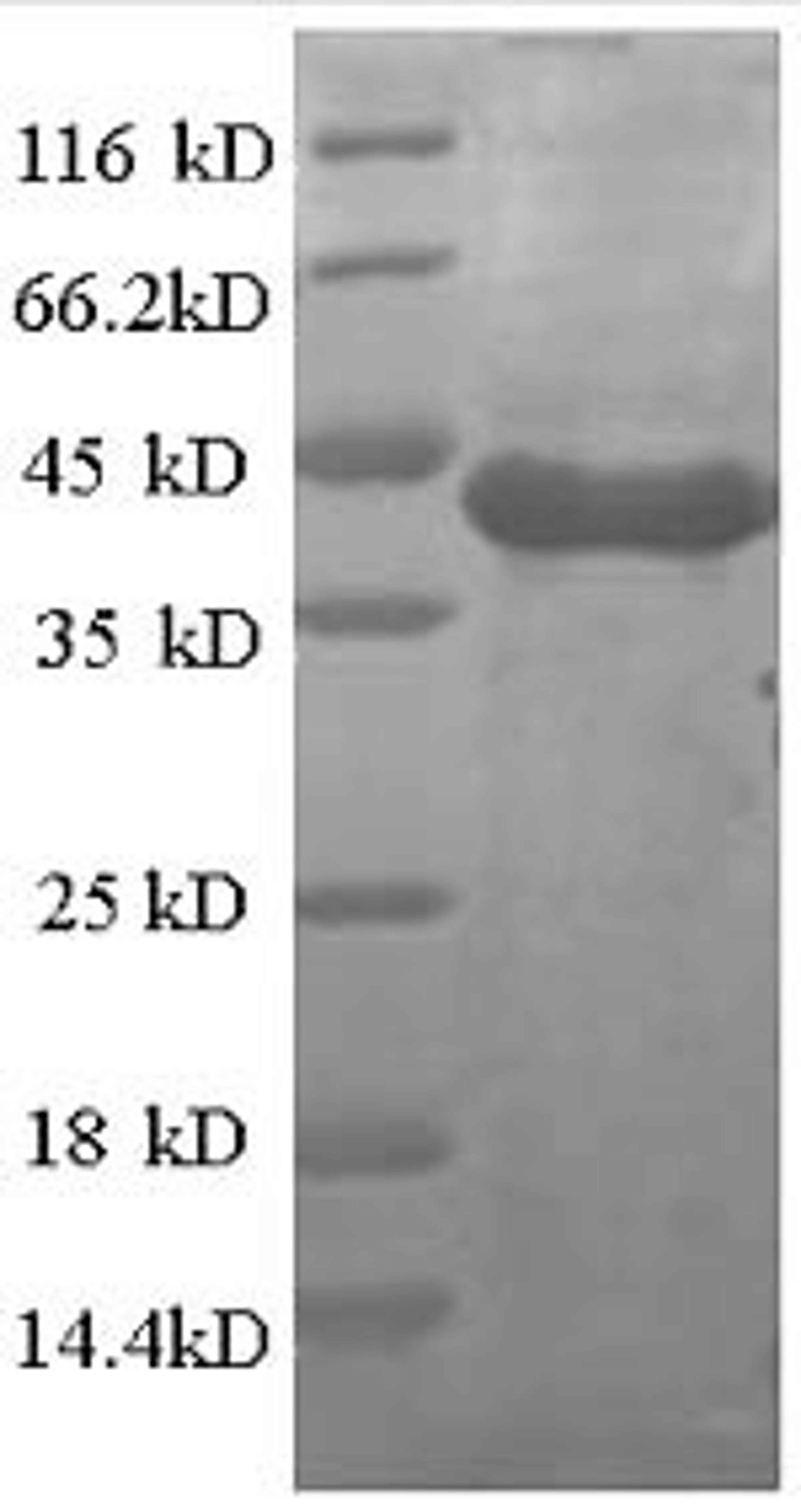 (Tris-Glycine gel) Discontinuous SDS-PAGE (reduced) with 5% enrichment gel and 15% separation gel.