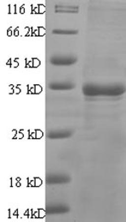 (Tris-Glycine gel) Discontinuous SDS-PAGE (reduced) with 5% enrichment gel and 15% separation gel.