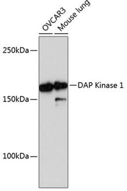 Western blot - DAP Kinase 1 Rabbit mAb (A11459)