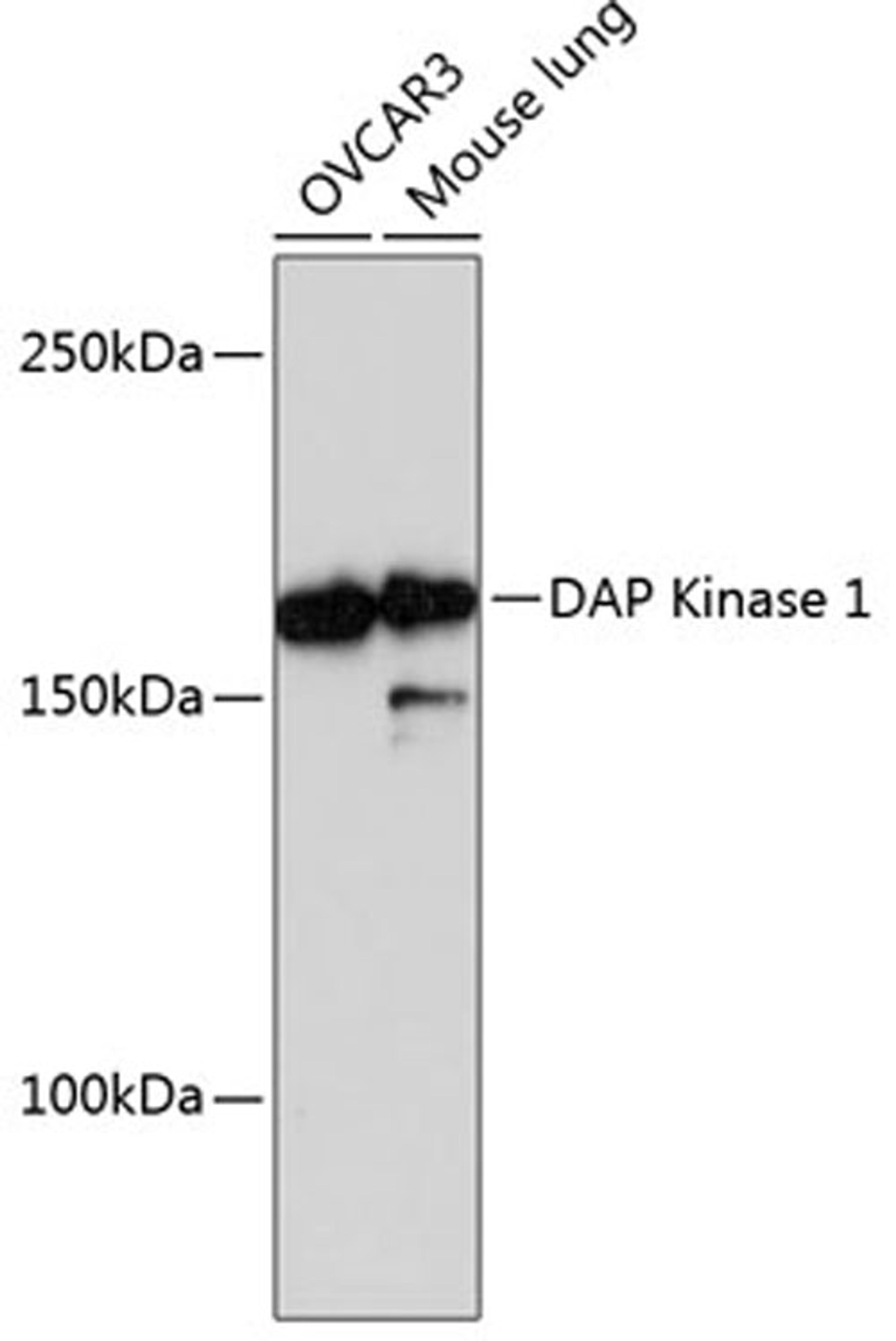 Western blot - DAP Kinase 1 Rabbit mAb (A11459)