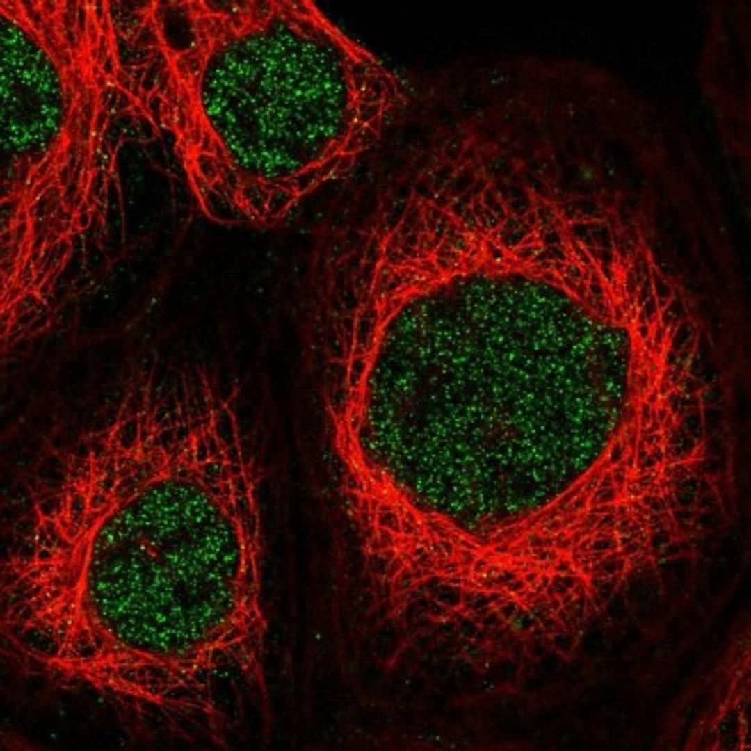 Immunocytochemistry/Immunofluorescence: ZNF83 Antibody [NBP1-83789] - Staining of human cell line A-431 shows positivity in nucleus but not nucleoli.