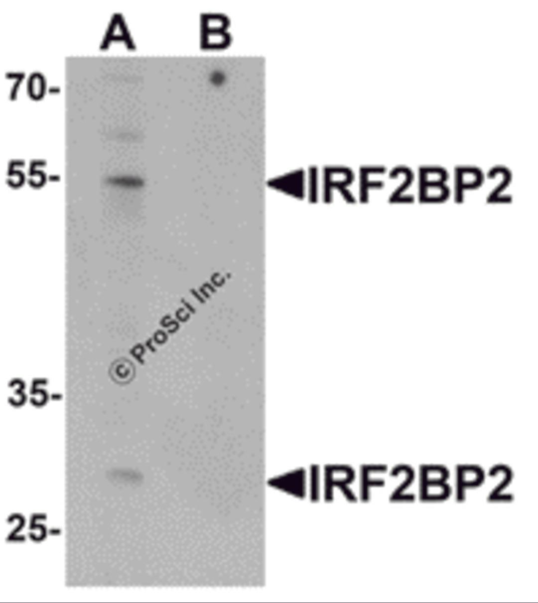 Western blot analysis of IRF2BP2 in HeLa cell lysate with IRF2BP2 antibody at 1 μg/mL in (A) the absence and (B) the presence of blocking peptide