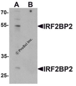 Western blot analysis of IRF2BP2 in HeLa cell lysate with IRF2BP2 antibody at 1 μg/mL in (A) the absence and (B) the presence of blocking peptide