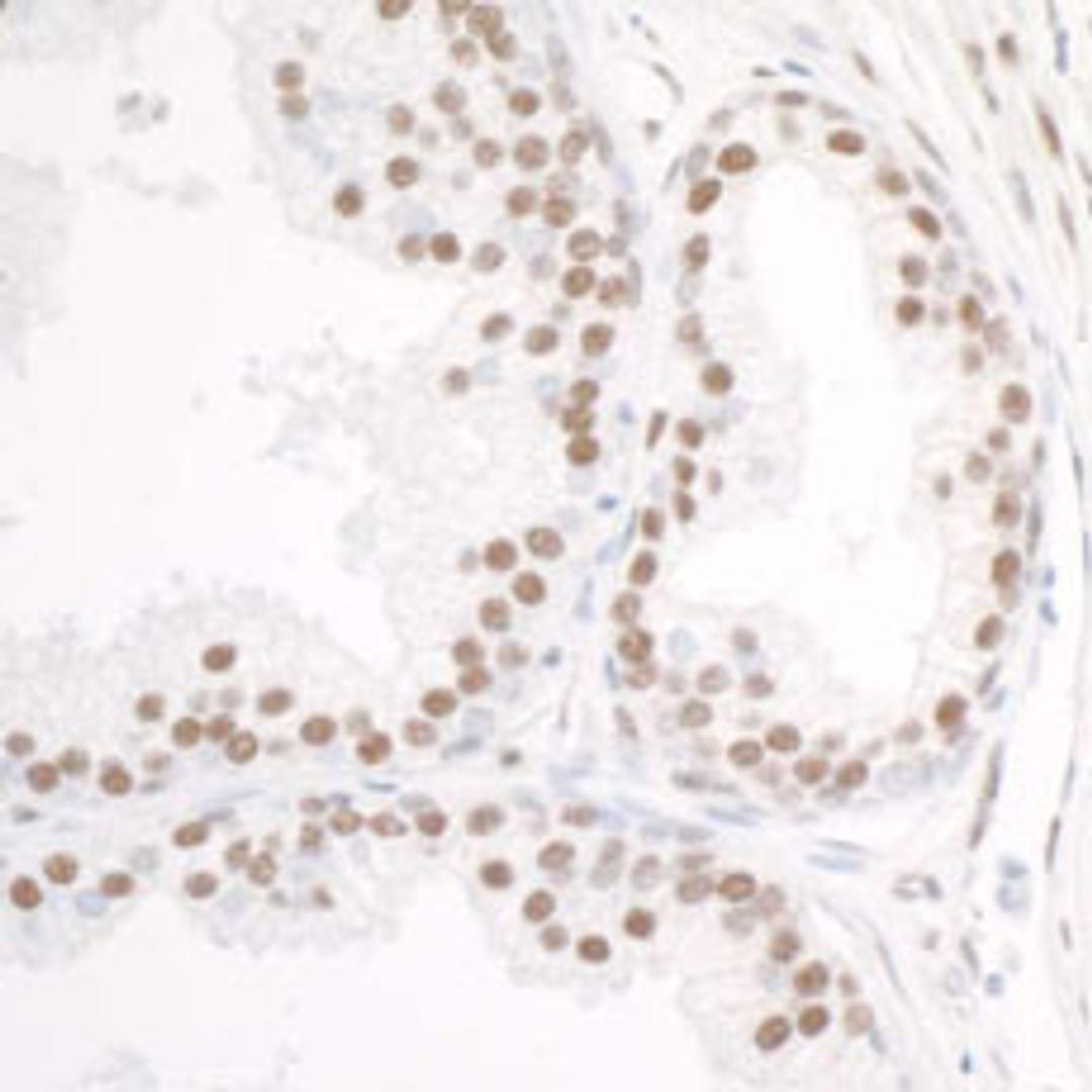 Detection of human DDX5 by immunohistochemistry.