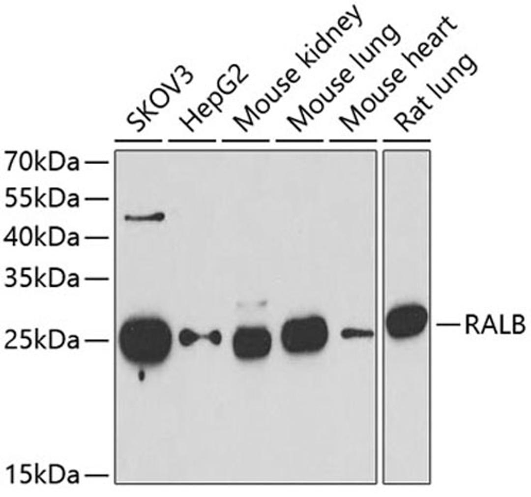 Western blot - RALB antibody (A6714)