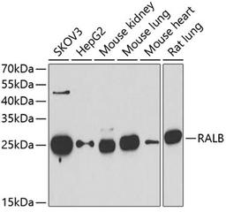 Western blot - RALB antibody (A6714)