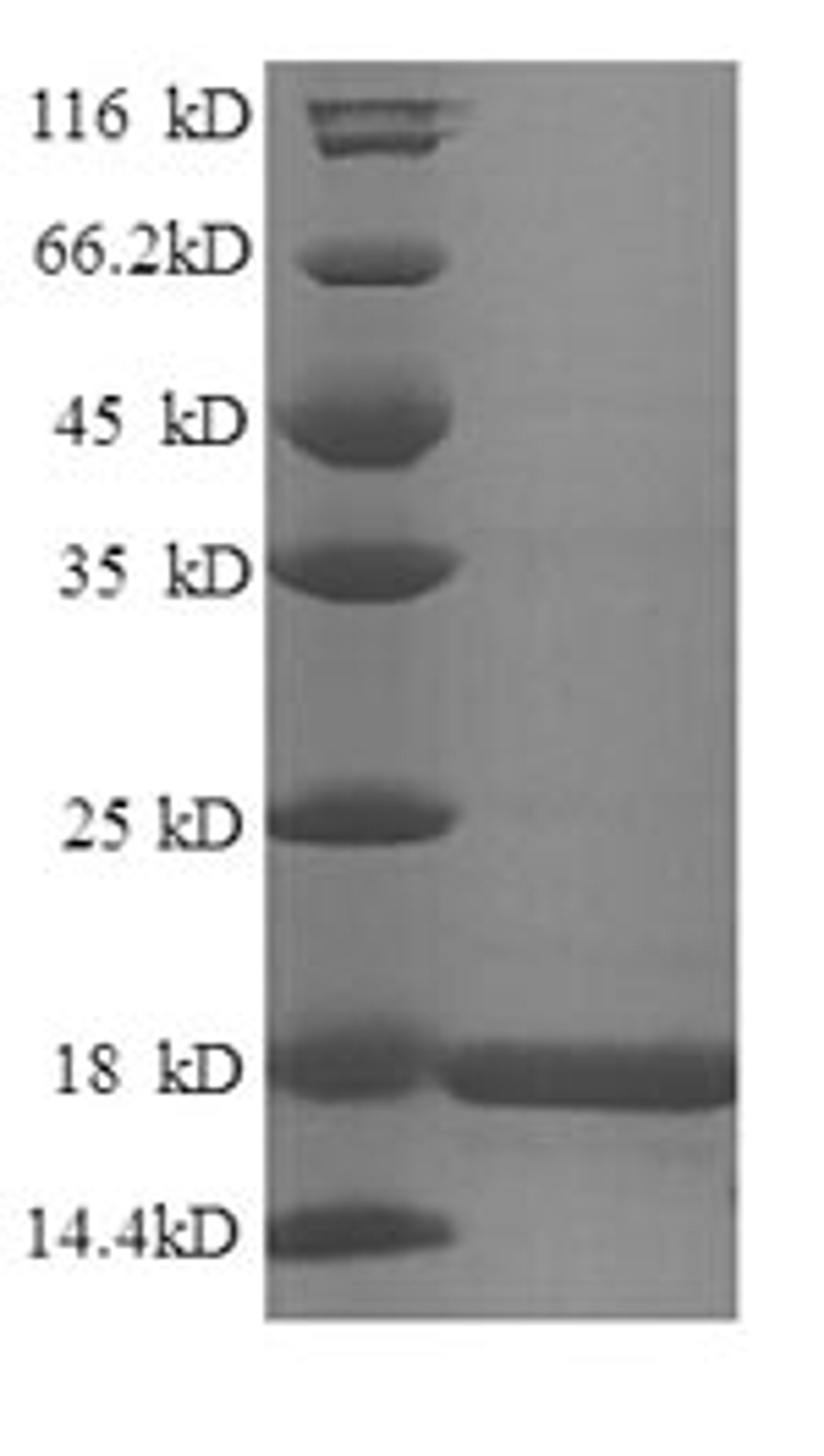 (Tris-Glycine gel) Discontinuous SDS-PAGE (reduced) with 5% enrichment gel and 15% separation gel.