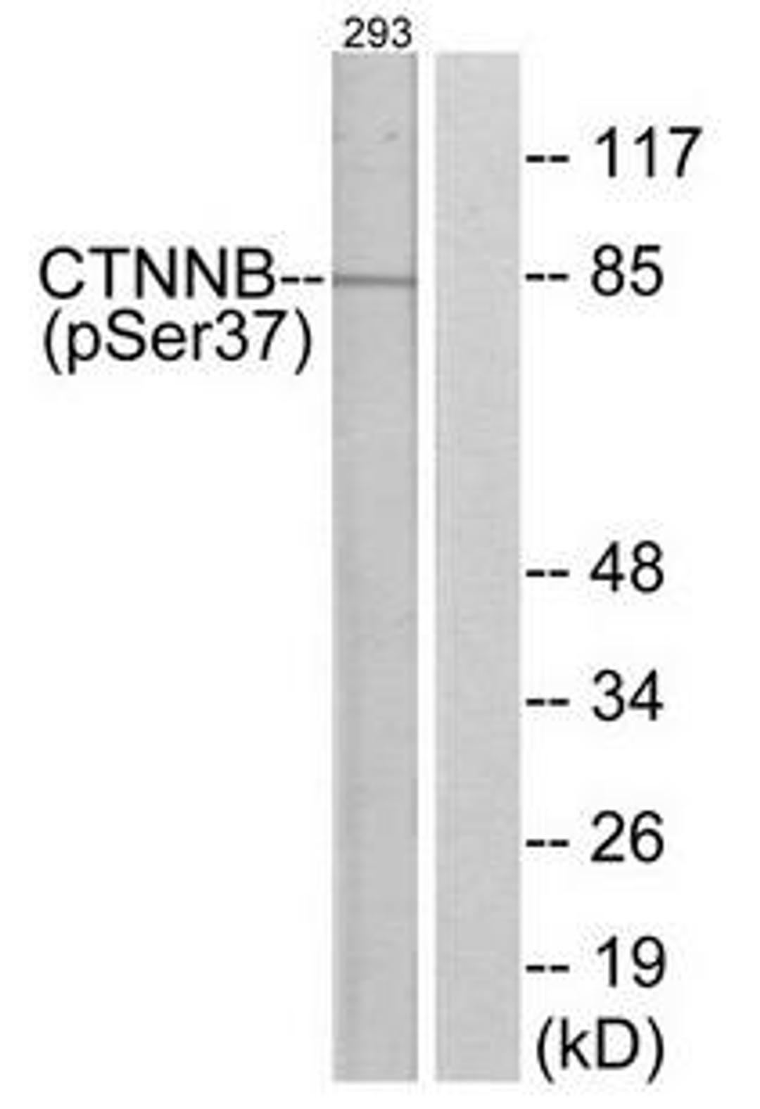 Western blot analysis of 293 cells using ?-Catenin (phospho-Ser37) antibody.