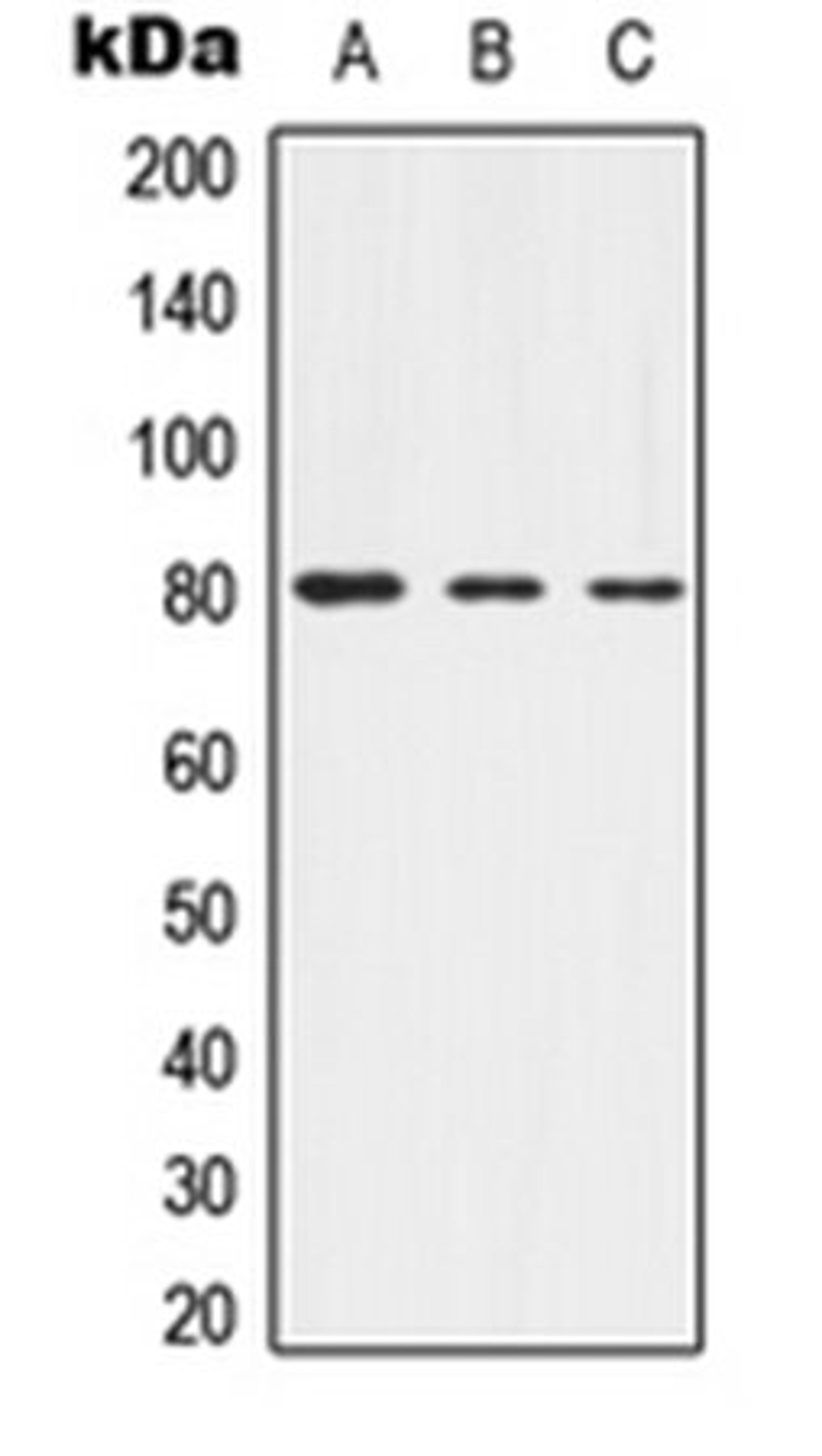 Western blot analysis of HEK293T (Lane 1), mouse brain (Lane 2), rat brain (Lane 3) whole cell lysates using Alpha-adducin (phospho-T445) antibody