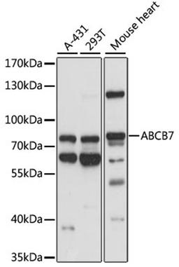 Western blot - ABCB7 antibody (A14699)