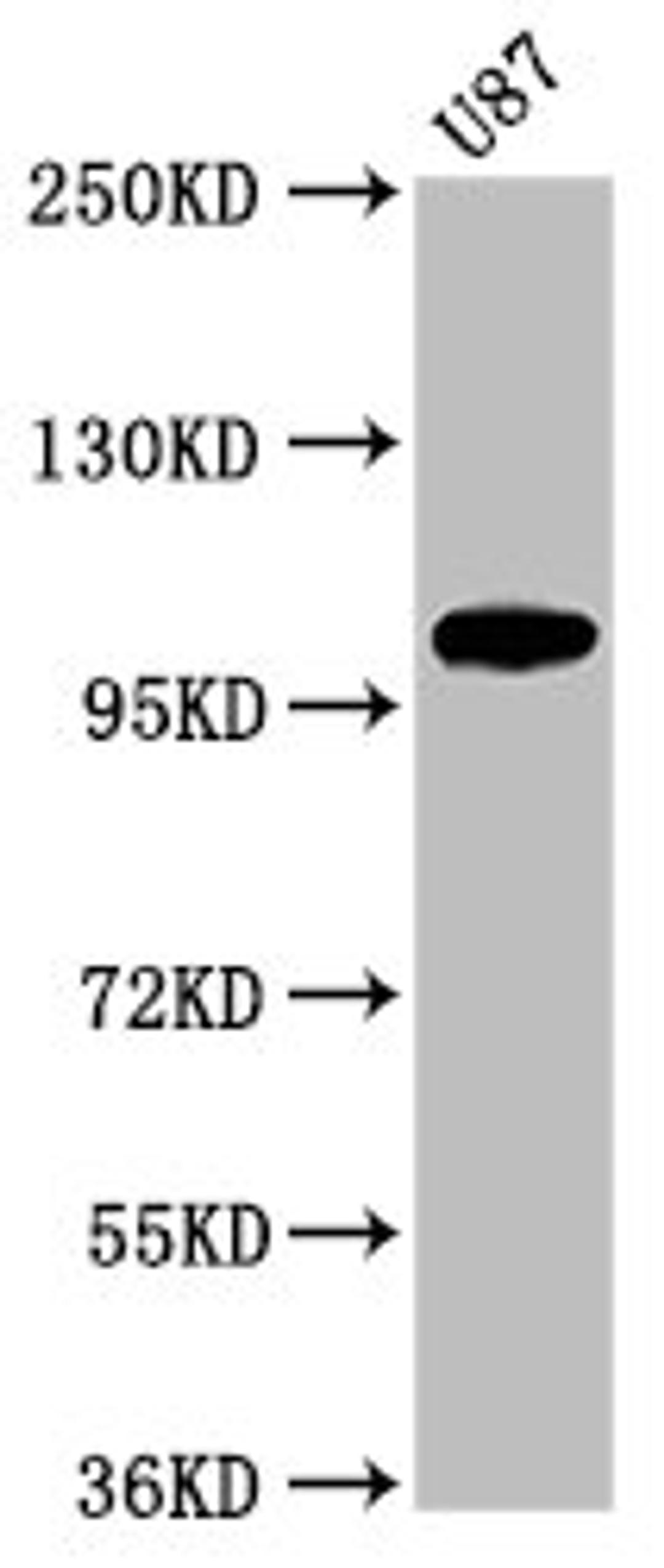 Western Blot. Positive WB detected in: U87 whole cell lysate. All lanes: LGR6 antibody at 2.5µg/ml. Secondary. Goat polyclonal to rabbit IgG at 1/50000 dilution. Predicted band size: 105, 90, 100 kDa. Observed band size: 105 kDa