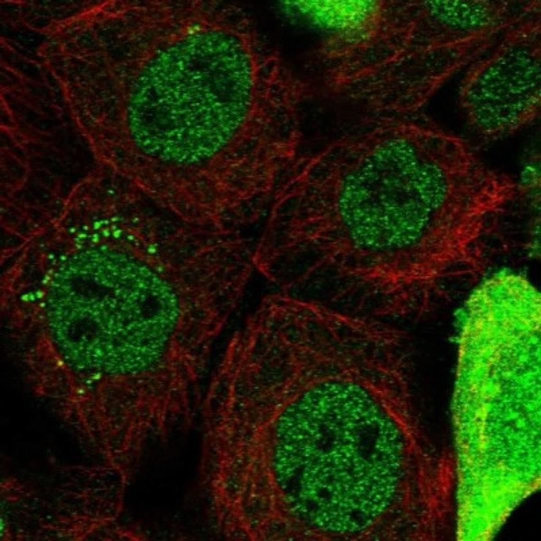 Immunocytochemistry/Immunofluorescence: CAPZB Antibody [NBP1-85922] - Immunofluorescent staining of human cell line A-431 shows positivity in nucleus but not nucleoli, cytoplasm & vesicles.