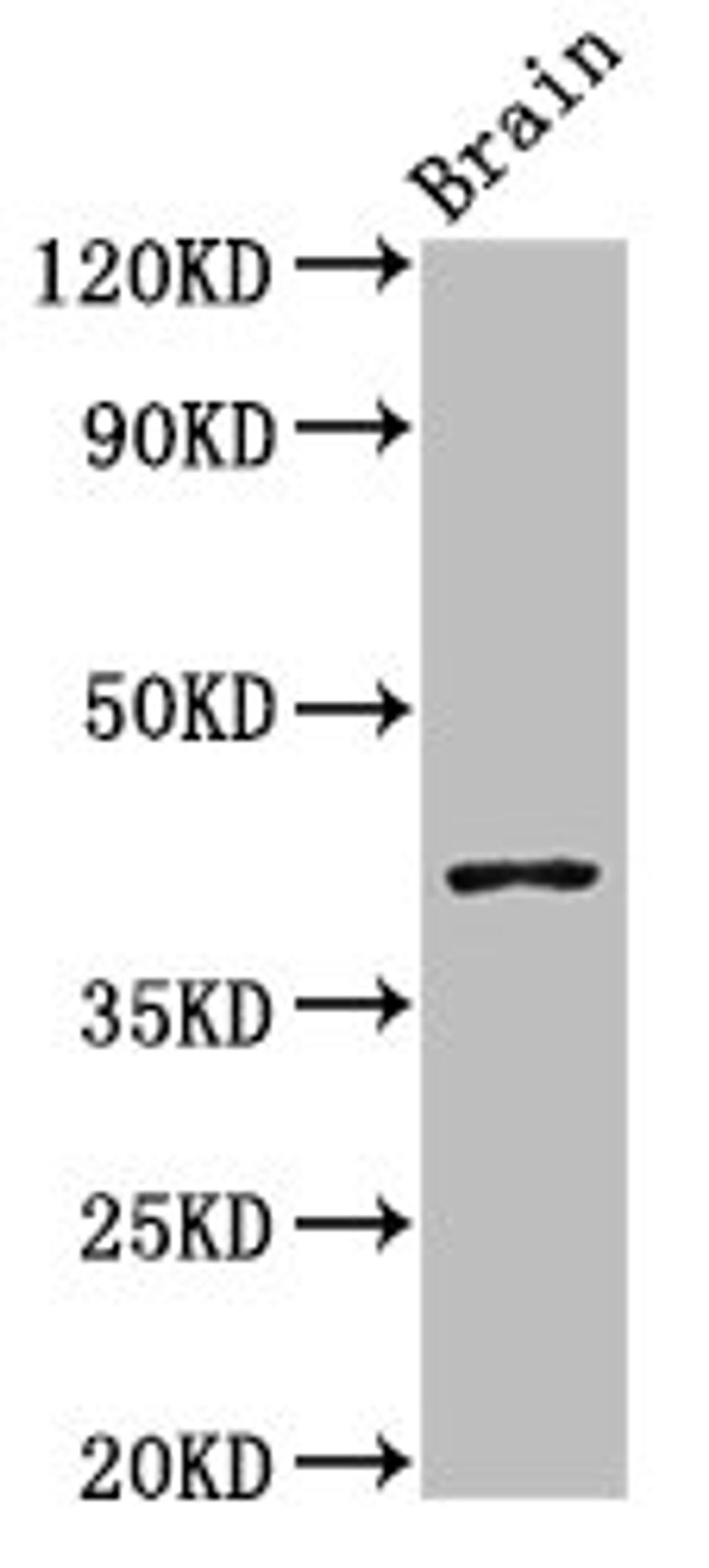 Western Blot. Positive WB detected in: Mouse brain tissue. All lanes: SEPT3 antibody at 3ug/ml. Secondary. Goat polyclonal to rabbit IgG at 1/50000 dilution. Predicted band size: 41, 10 kDa. Observed band size: 41 kDa.