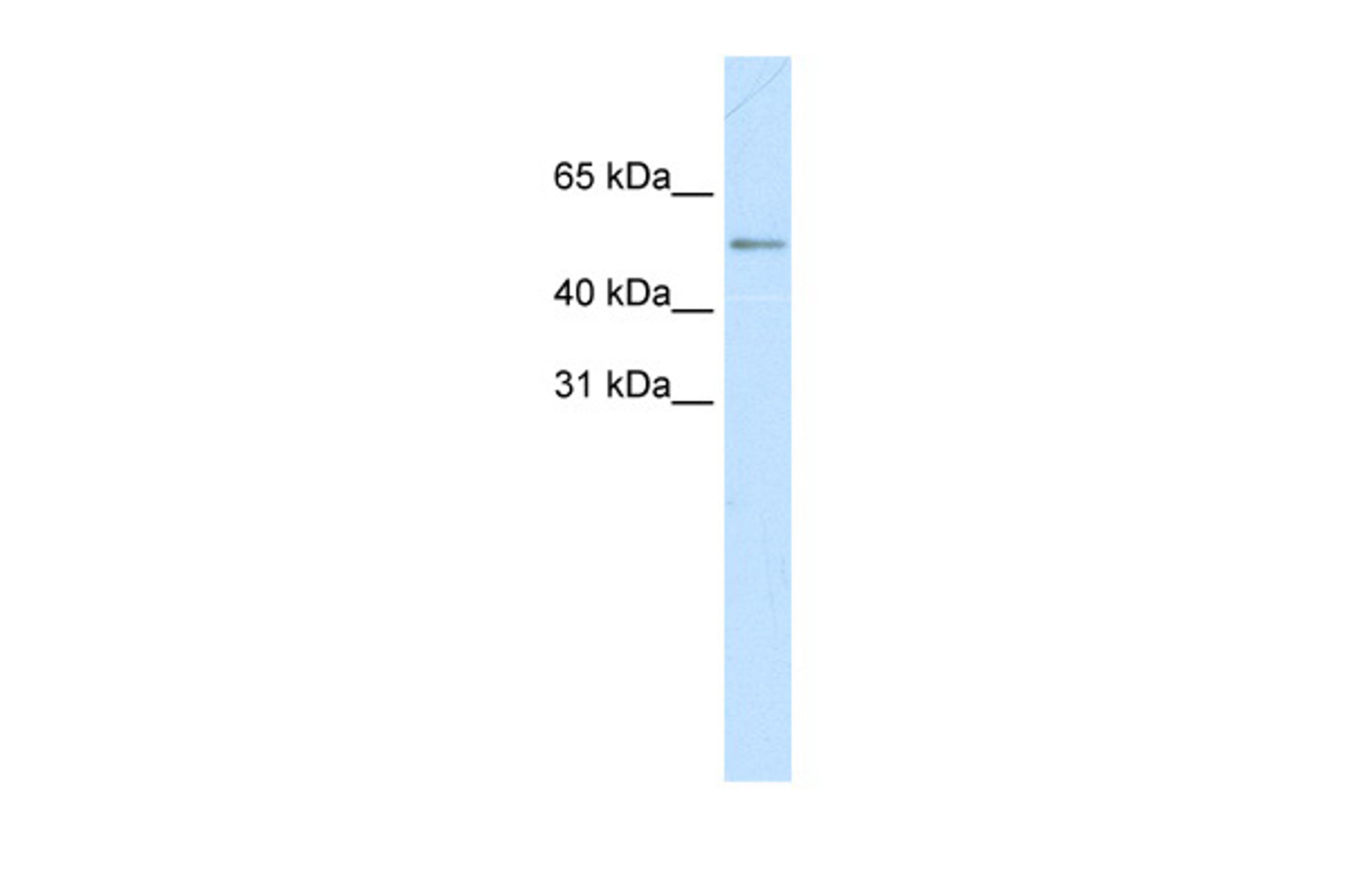 Antibody used in WB on Human Small Intestine at 0.2-1 ug/ml.