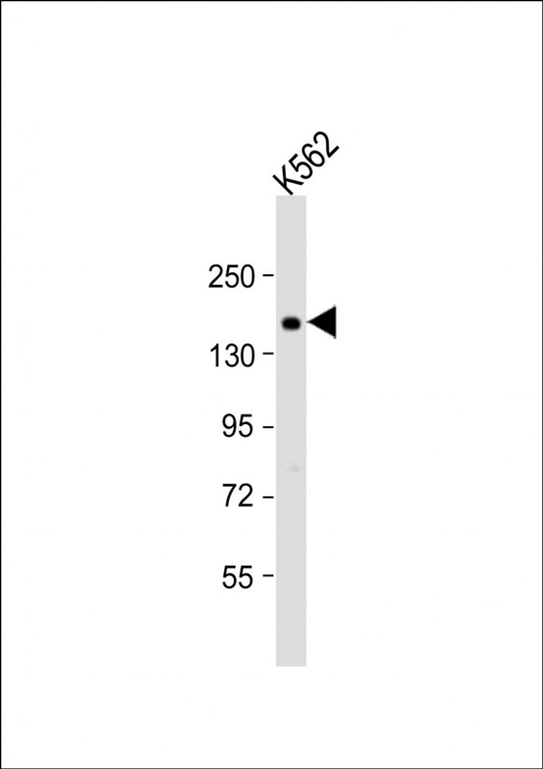 Western Blot at 1:1000 dilution + K562 whole cell lysate Lysates/proteins at 20 ug per lane.