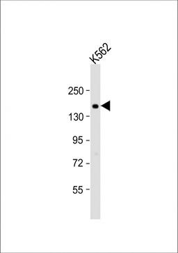 Western Blot at 1:1000 dilution + K562 whole cell lysate Lysates/proteins at 20 ug per lane.