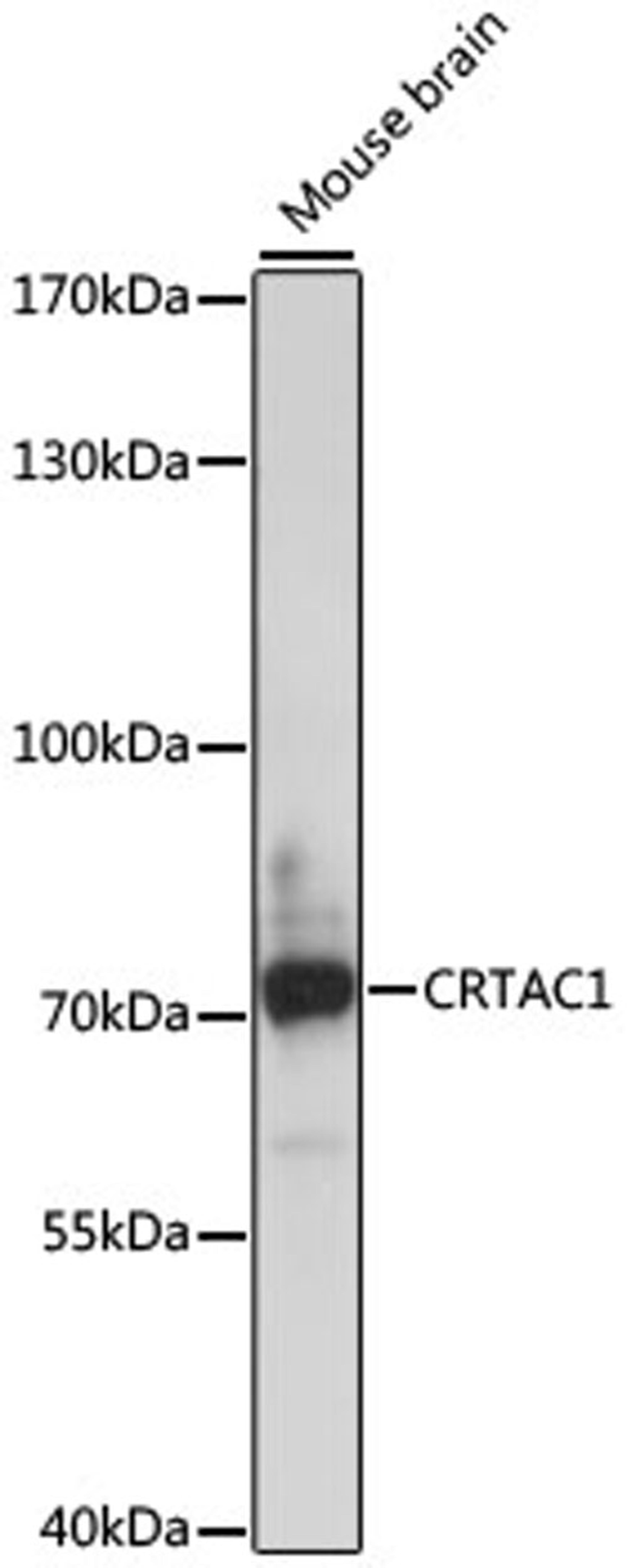 Western blot - CRTAC1 antibody (A16541)