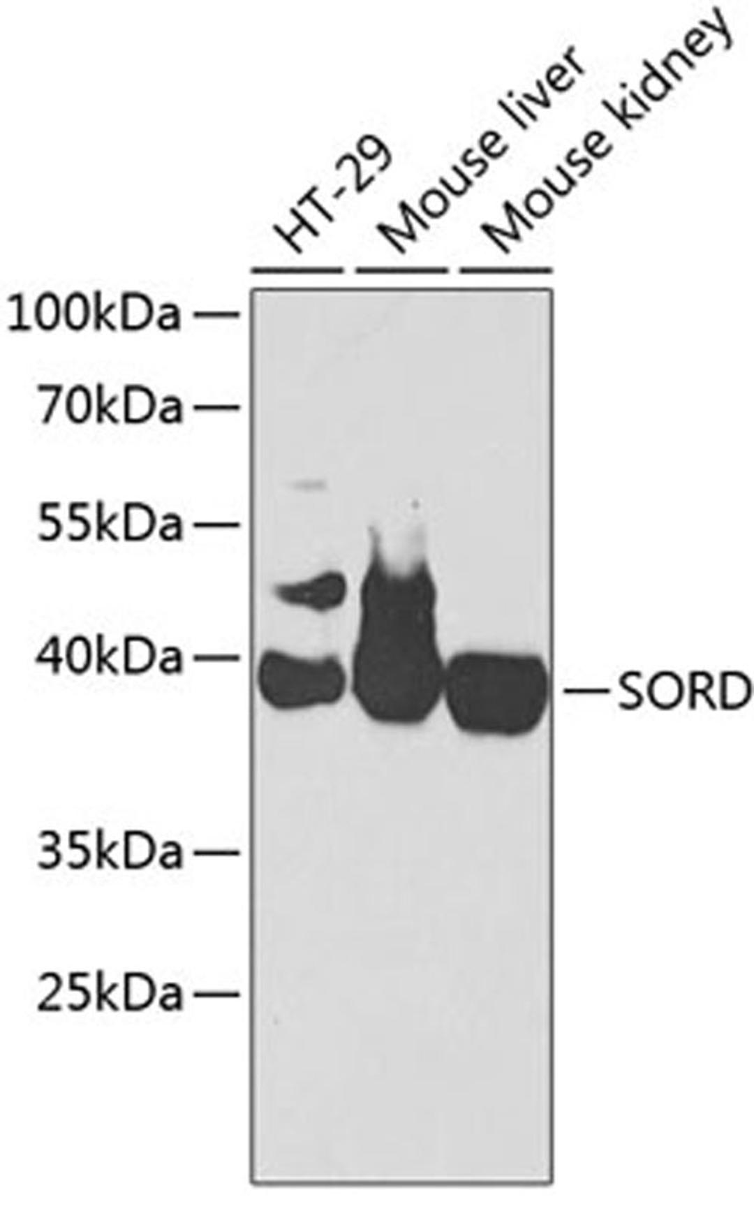 Western blot - SORD antibody (A2118)