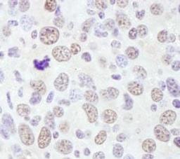 Detection of mouse RNF138 by immunohistochemistry.