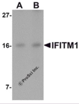 Western blot analysis of IFITM1 in Jurkat cell lysate with IFITM1 antibody at (A) 2.5 and (B) 5 &#956;g/mL.